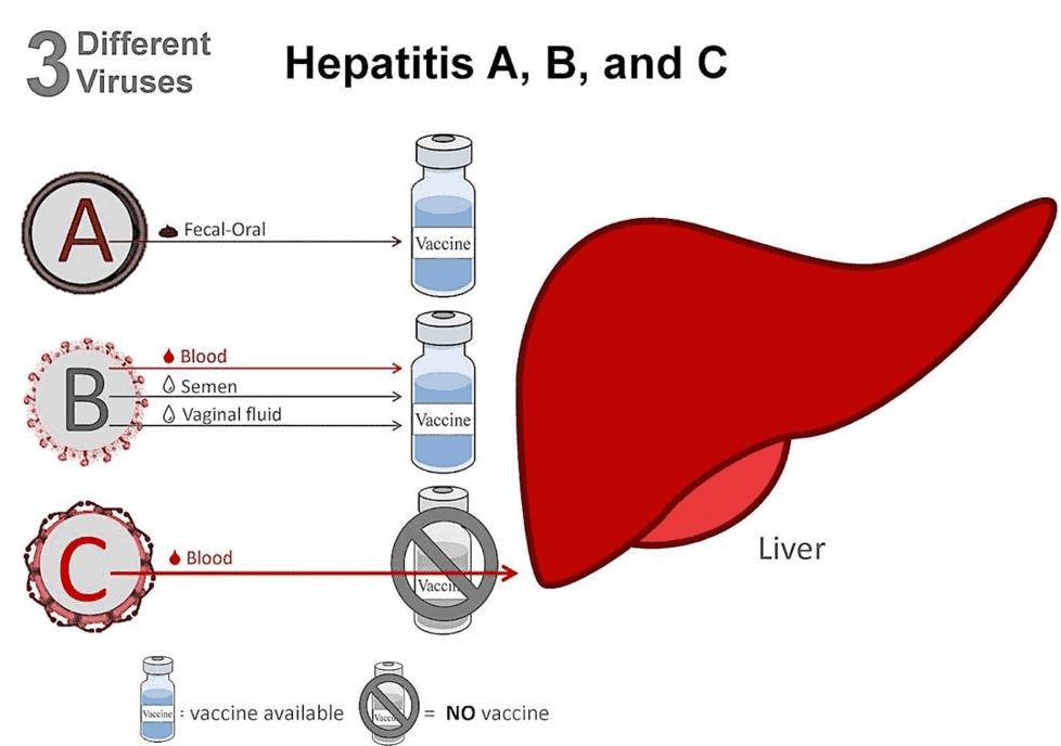 Hepatitis A, B and C
