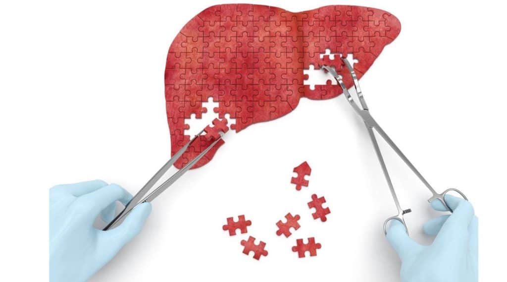 Hepatitis and the liver