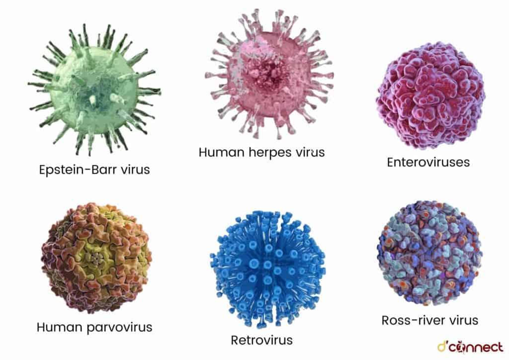 Epstein-Barr virus and CFS