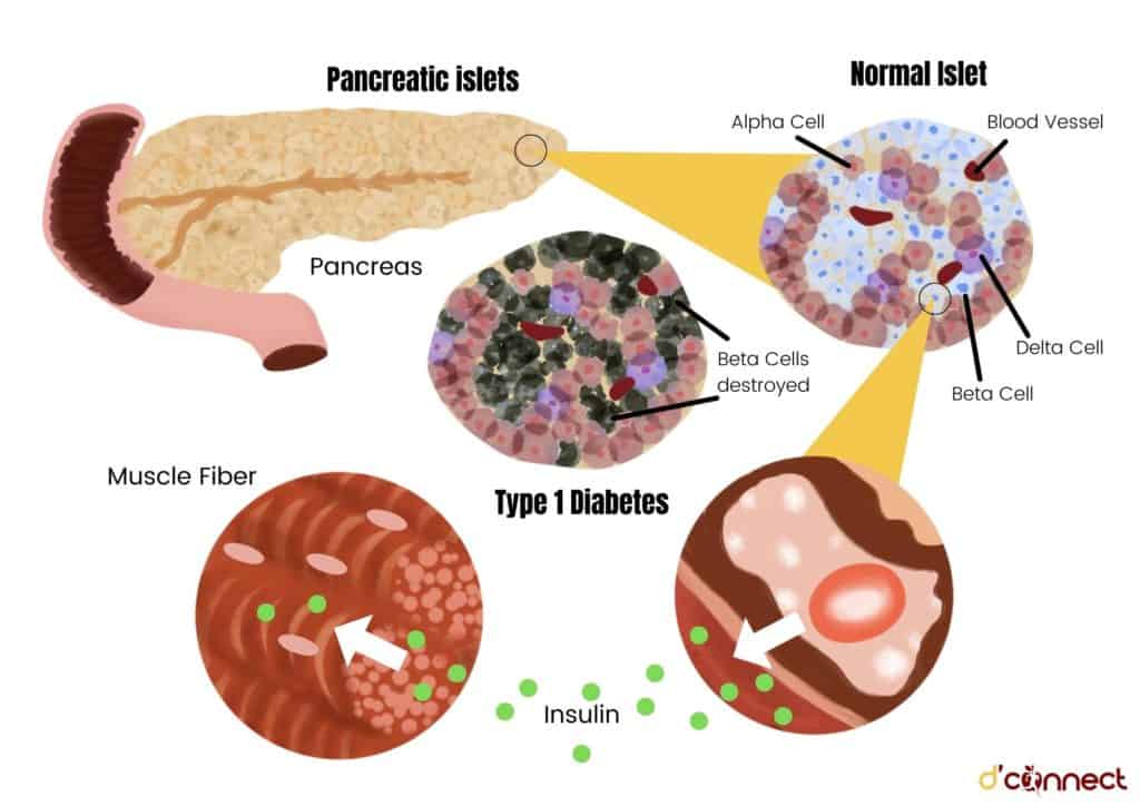 Pancreas, insulin and diabetes