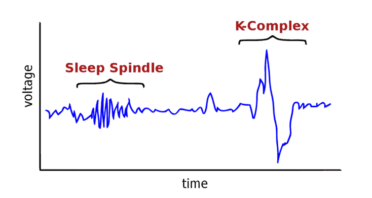 Sleep spindle and K-complex