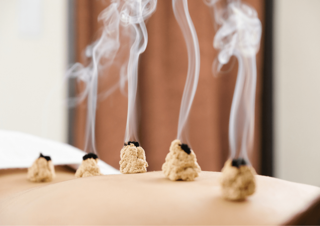 Traditional-Chinese-medicine-moxibustion