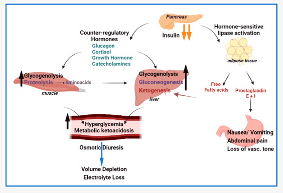 Diabetic ketoacidosis