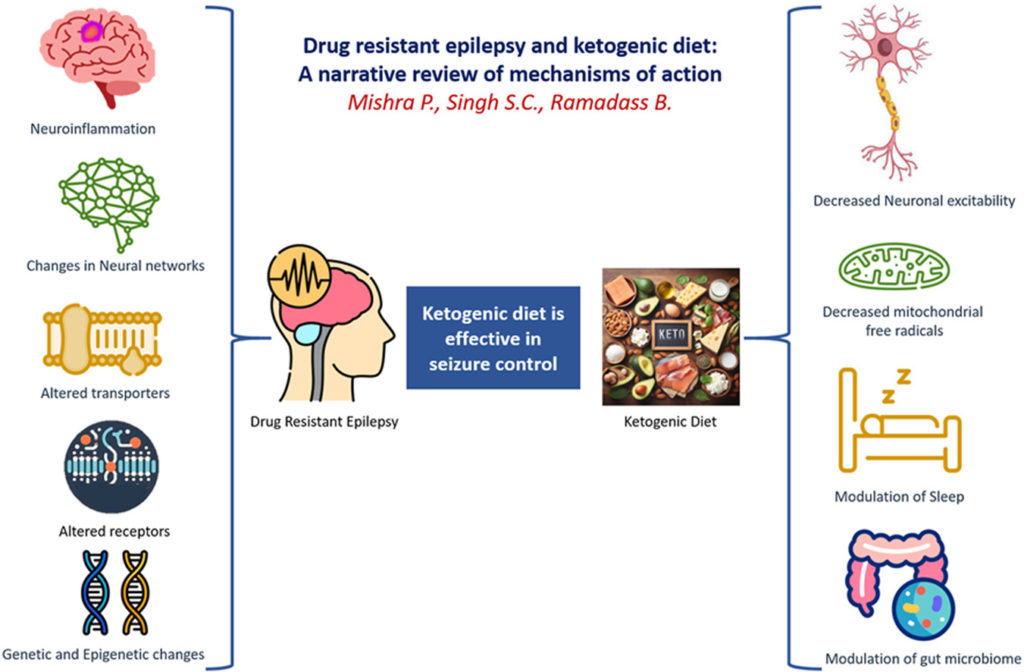 Drug resistant epilepsy and ketogenic diet