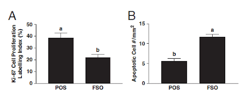 Effect of flaxseed oil (FSO) on human breast cancer tumor