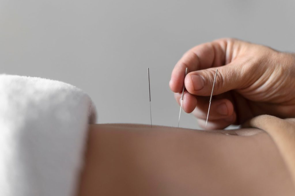 Stomach acupuncture