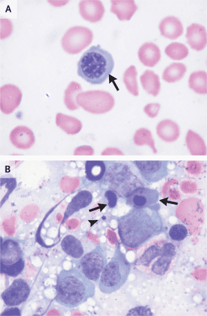 Vitamin B12 and anemia