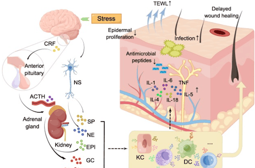 Effects of stress on skin barrier
