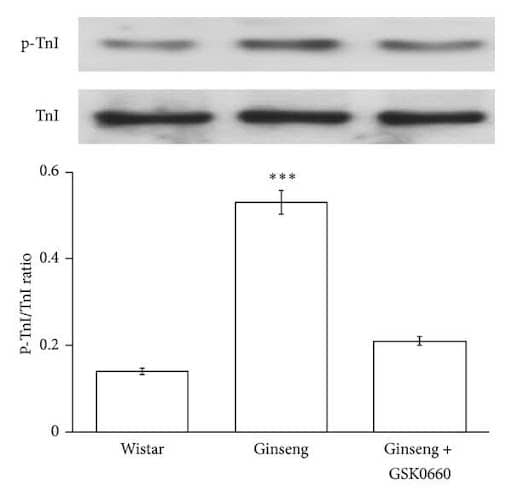 Effect of ginseng in rat heart health B