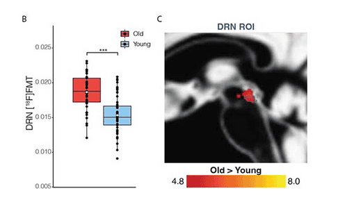 PET imaging of higher serotonin synthesis