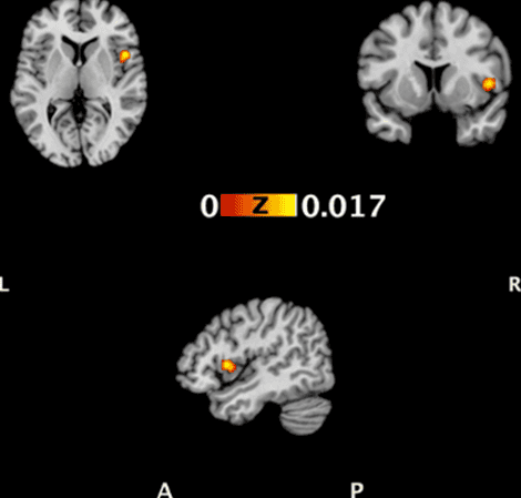 Body scan and brain activity