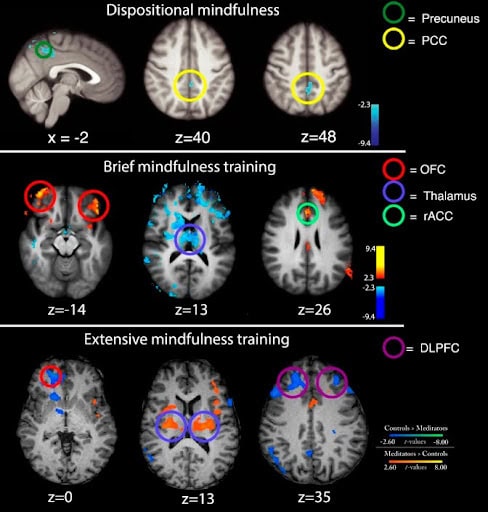 Mindfulness training and brain activity