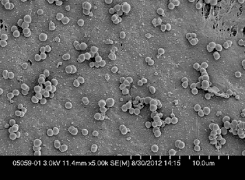 S. aureus biofilms