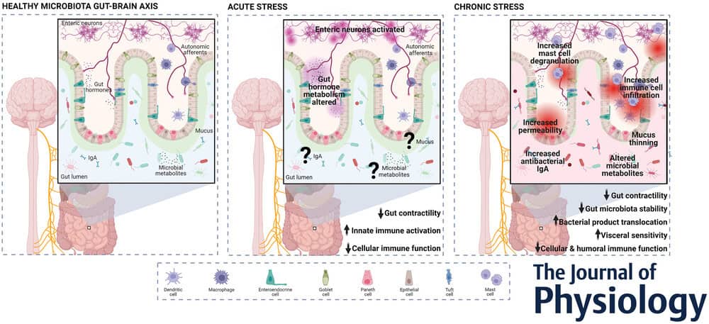 Stress and Gut Health